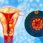 طريقة الكشف المبكر عن سرطان عنق الرحم النساء في الفن