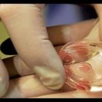 استشاري نساء وتوليد ينصح بتجميد البويضات في ظل تأخر سن الزواج النساء في الفن